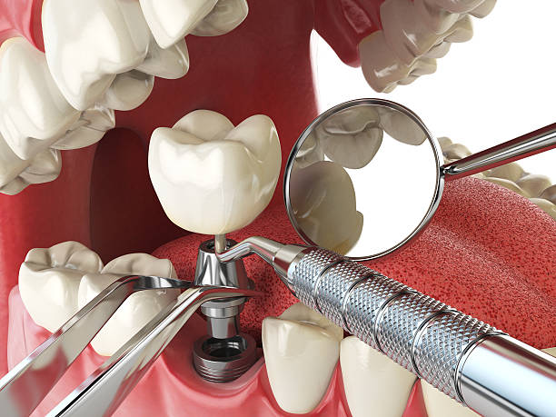 Best Urgent Dental Care for Toothaches in Clksville, AR